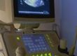 Ultrasounds and Endometrial Biopsies