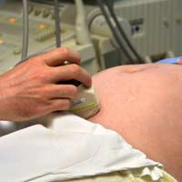 Infertility Infertility Treatment Ivf In