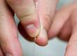 Using Acupuncture To Aid Fertility