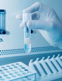 Semen Analysis Hormonal Testing Male