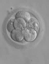 Inra-cytoplasmic Sperm Injection Is A