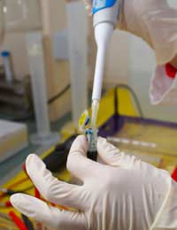 pre-implantation Genetic Diagnosis
