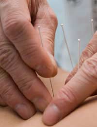 Alternative Medicine Chinese Medicine
